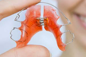 Kieferorthopädie Dr. Hellak lose Zahnspange